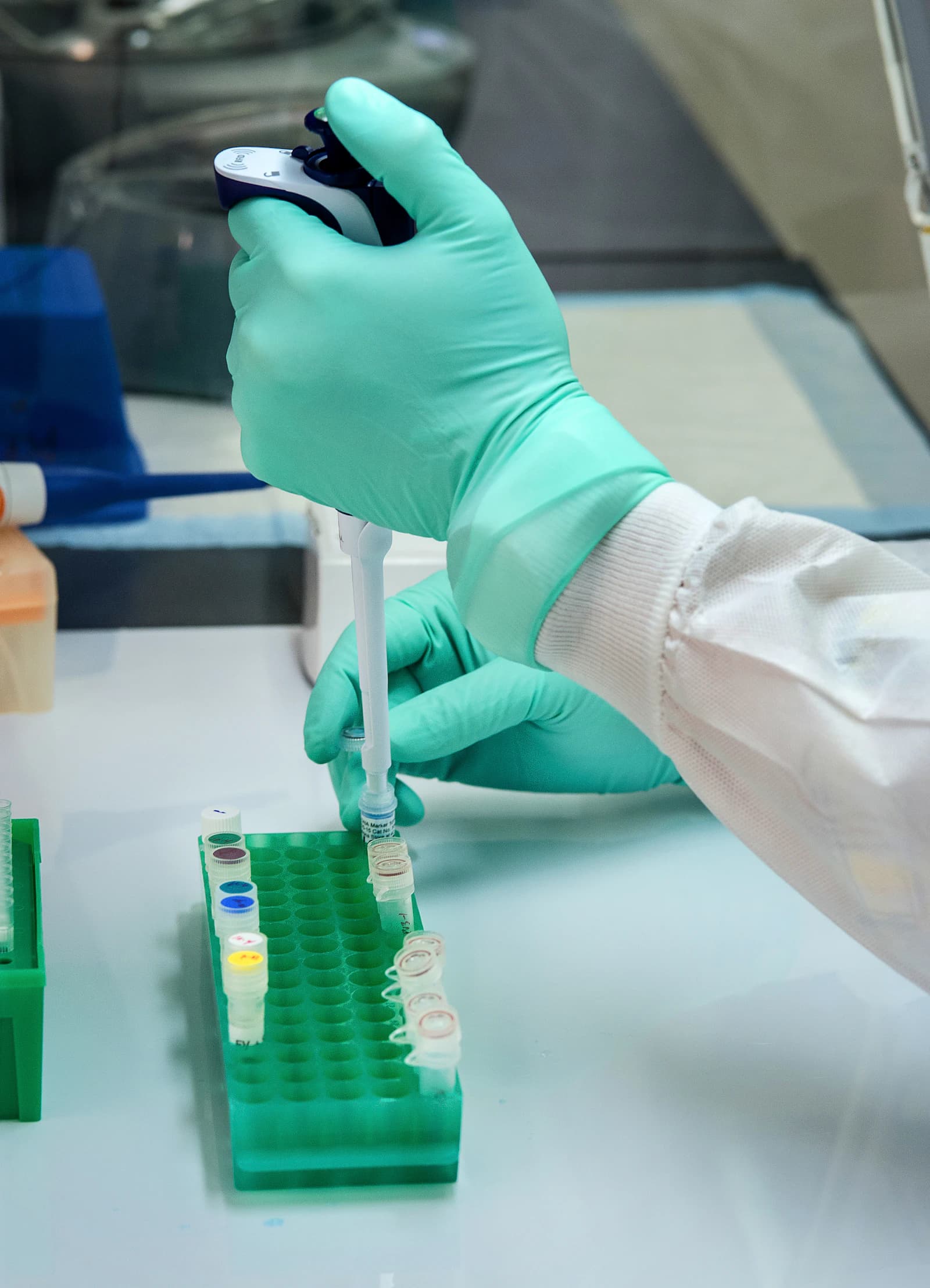 Medical laboratory professional preparing samples with a pipette